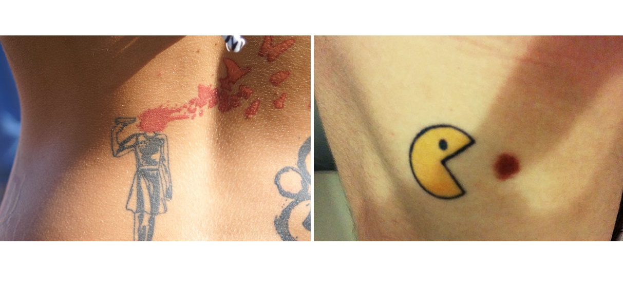 Zseniális ahogy az anyajegyeiket tetoválással egészítették ki ezek az emberek