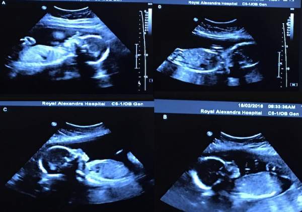 Teljes döbbenettel pillantották meg, mi van a várandós nő ultrahangján