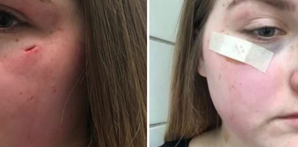Légpuskával lőttek arcon egy 16 éves lányt a buszmegállóban Székesfehérváron – fotók